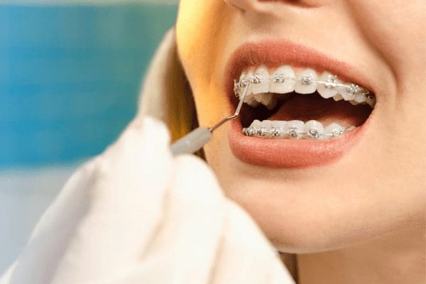 The-History-Of-Orthodontics