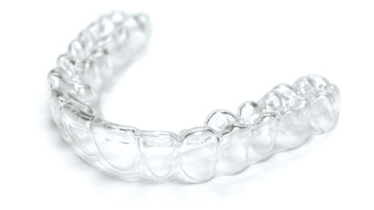What To Expect With Invisalign