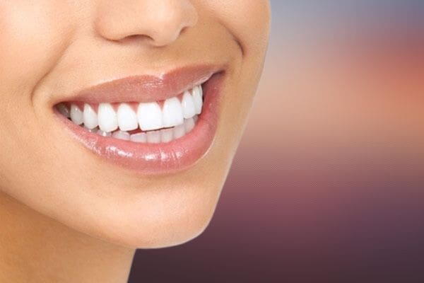 How Much Is Invisalign?